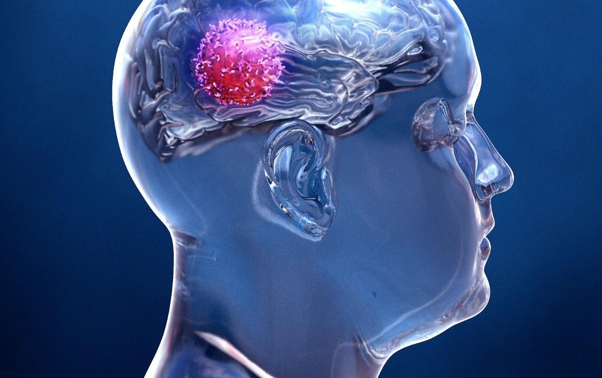 طراحی نانوذراتی شانس بین بردن تومورهای بدخیم افزایش می‌دهند